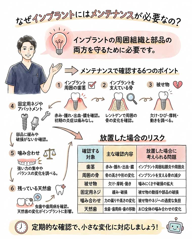 なぜインプラントにはメンテナンスが必要なの？の図解