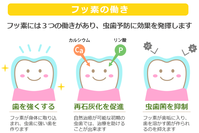 歯科医院での子どもの虫歯予防について教えて 梅田クローバー歯科よくあるご質問