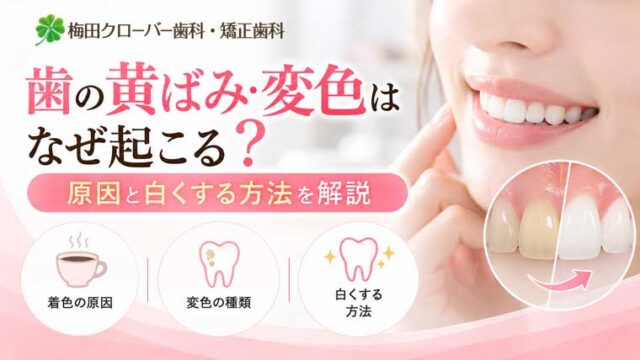 歯の黄ばみ・変色はなぜ起こる？原因と白くする方法を解説