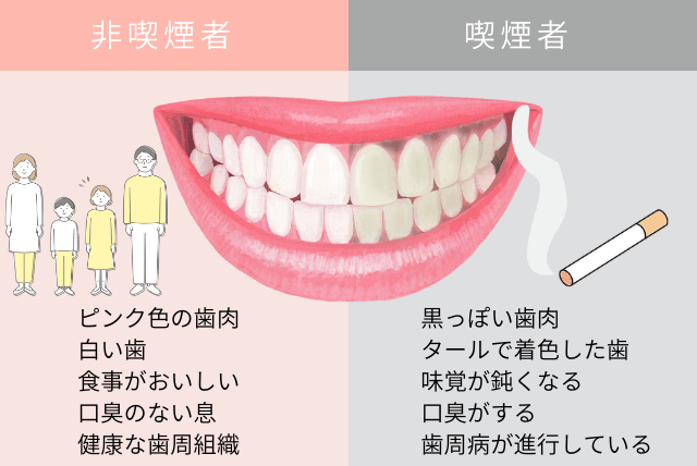 喫煙者と非喫煙者の歯の比較