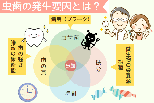 虫歯の発生要因とは？