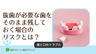抜歯が必要な歯をそのまま残しておく場合のリスクとは？