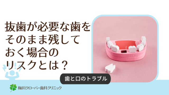 抜歯が必要な歯をそのまま残しておく場合のリスクとは？