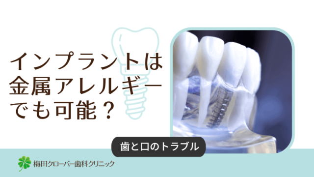 インプラントは金属アレルギーでも可能？