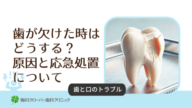 歯が欠けたときはどうする？原因と応急処置について