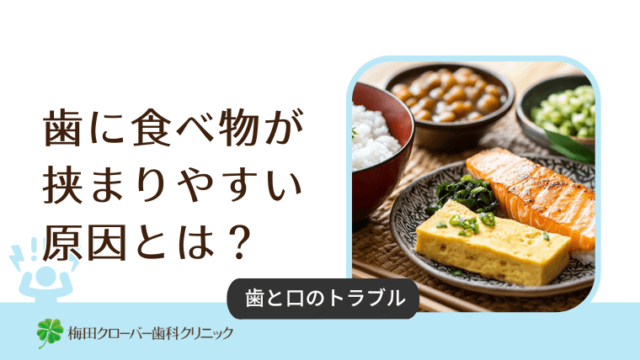 歯に食べ物が挟まりやすい原因とは？