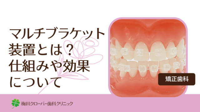 マルチブラケット装置とは？仕組みや効果について