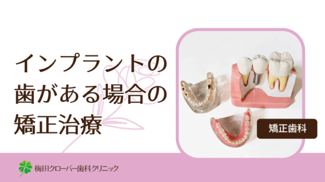 インプラントの歯がある場合の矯正治療