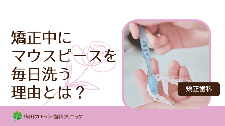矯正中にマウスピースを毎日洗う理由とは?