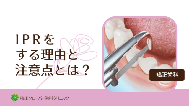 IPRをする理由と注意点とは？