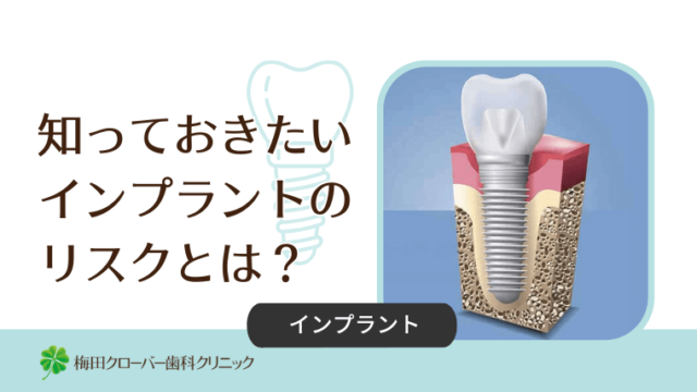 知っておきたいインプラントのリスクとは？