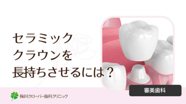 セラミッククラウンを長持ちさせるには？