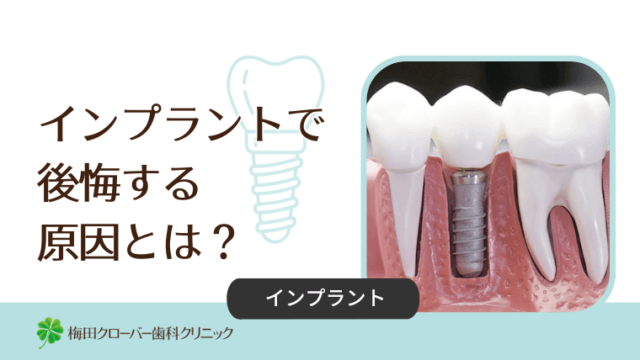インプラントで後悔する原因とは？