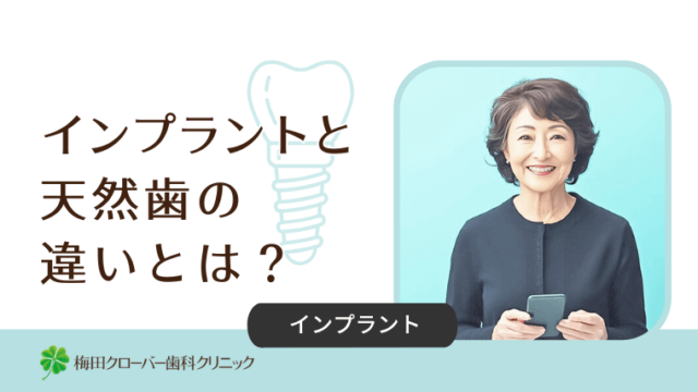 インプラントと天然歯の違いとは？