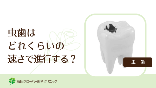 虫歯はどれくらいの速さで進行する？