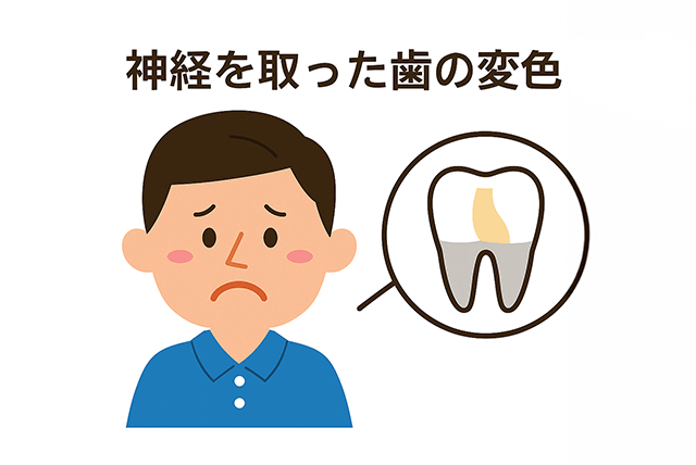 神経を取った歯