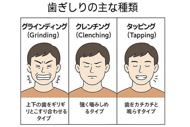 歯ぎしりの種類
