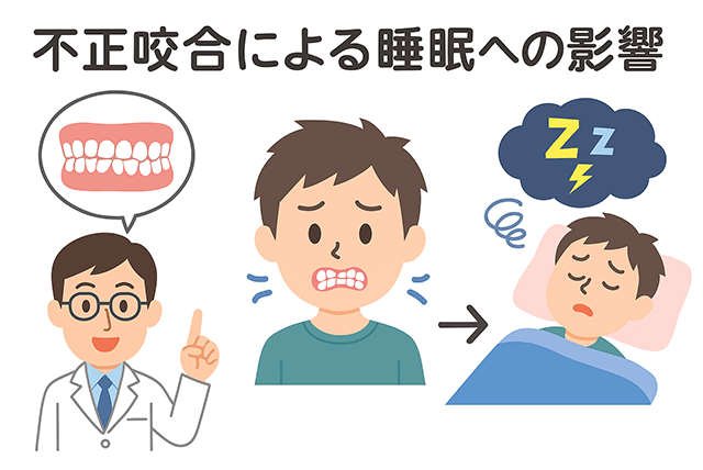 不正咬合による睡眠への影響