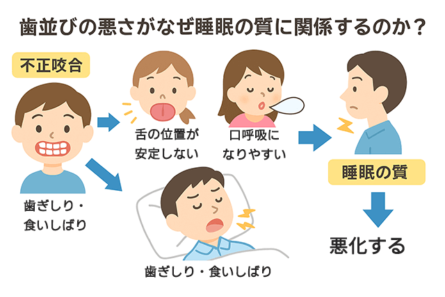 歯並びの悪さが睡眠の質に関係する理由