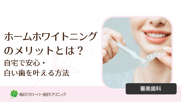 ホームホワイトニングのメリットとは?