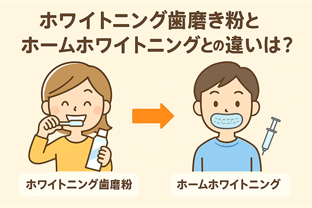 ホームホワイトニングとの違いは?