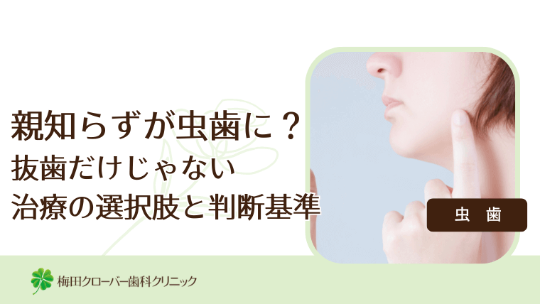 親知らずが虫歯に？抜歯だけじゃない治療の選択肢と判断基準