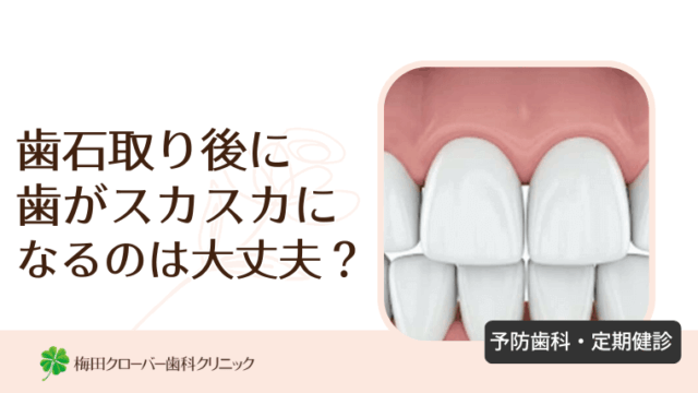 歯石取り後に歯がスカスカになるのは大丈夫？