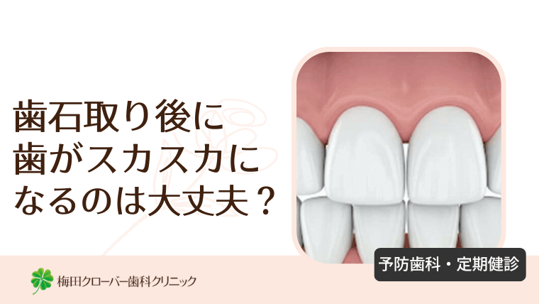 歯石取り後に歯がスカスカになるのは大丈夫？