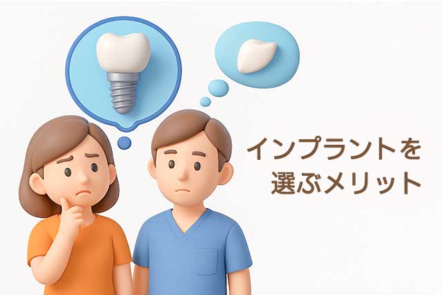 インプラントを選ぶメリット