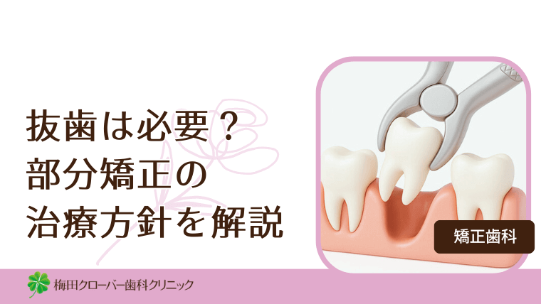 抜歯は必要？部分矯正の治療方針を解説