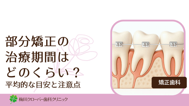 部分矯正の治療期間はどのくらい?