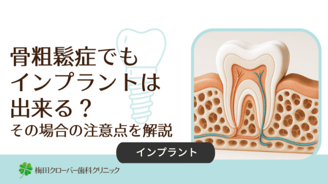 骨粗鬆症でもインプラントは出来る？