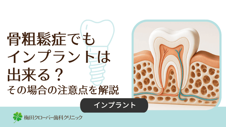 骨粗鬆症でもインプラントは出来る?