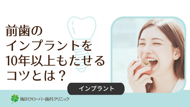 前歯のインプラントを10年以上もたせるコツとは？