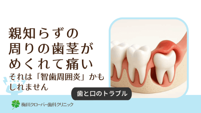 親知らずの周りの歯茎がめくれて痛い