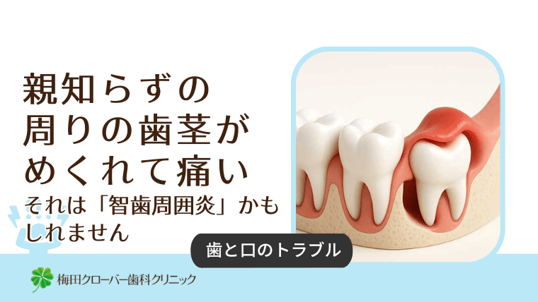 親知らずの周りの歯茎がめくれて痛い