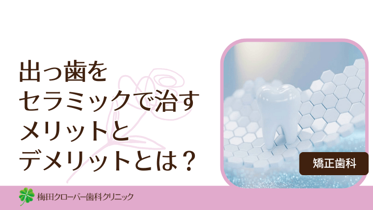 出っ歯をセラミックで治すメリットとデメリットとは？