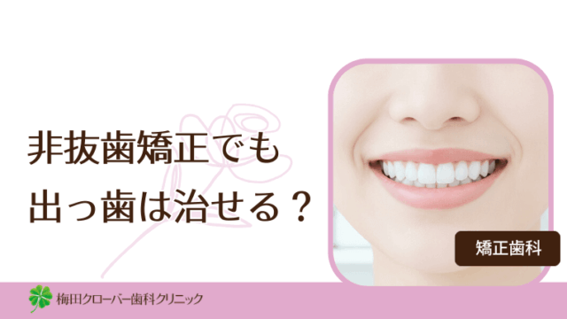非抜歯矯正でも出っ歯は治せる？