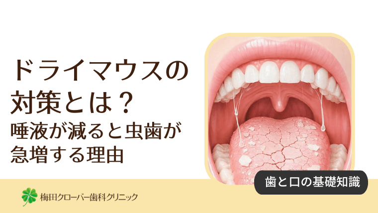 ドライマウスの対策とは？唾液が減ると虫歯が急増する理由