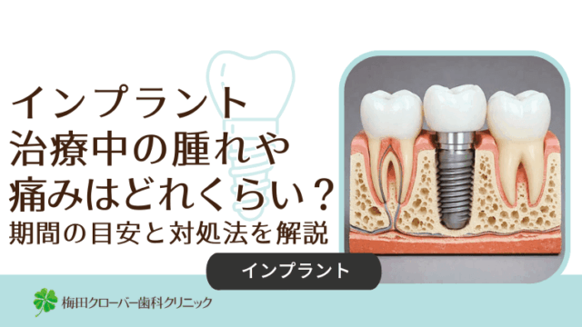インプラント治療中の腫れや痛みはどれくらい？期間の目安と対処法を解説