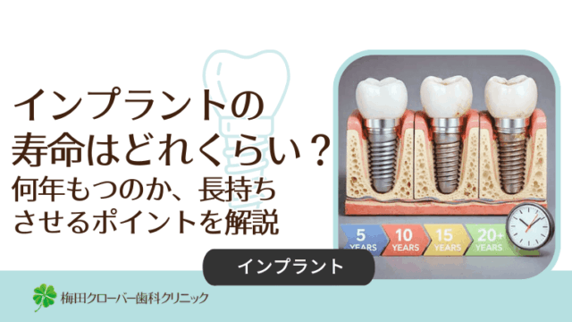 インプラントの寿命はどれくらい？何年もつのか、長持ちさせるポイントを解説