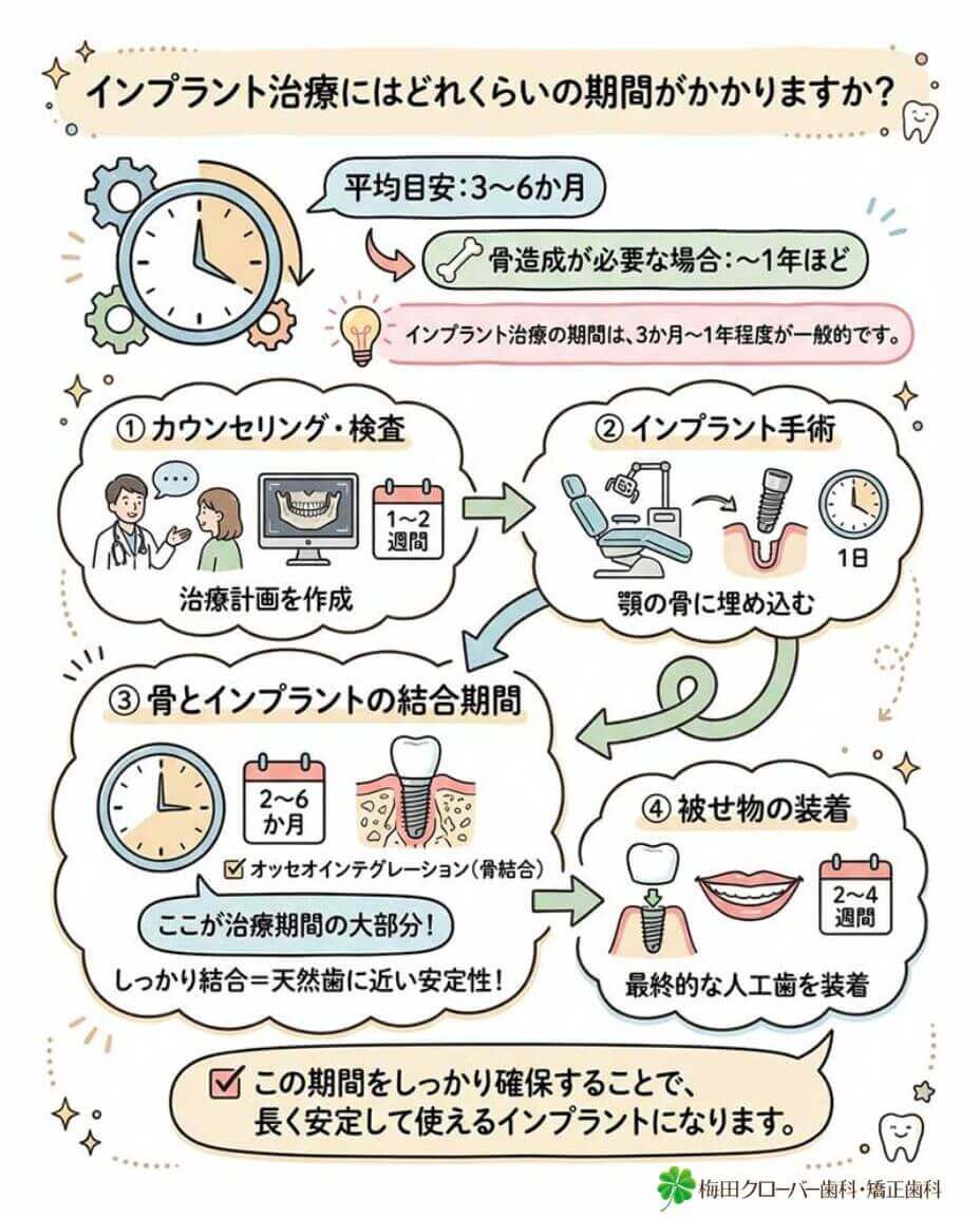 インプラント治療にはどれくらいの期間がかかりますか？