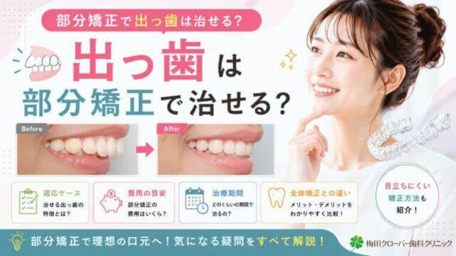 部分矯正で出っ歯は治せる？適応ケース・費用・期間・全体矯正との違いを解説