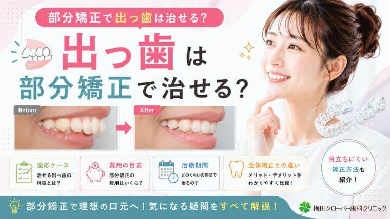 部分矯正で出っ歯は治せる？適応ケース・費用・期間・全体矯正との違いを解説
