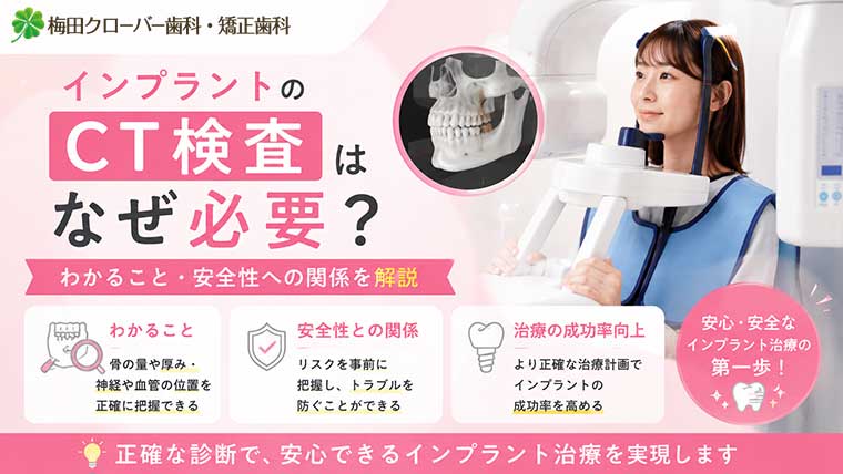 インプラントのCT検査はなぜ必要？わかること・安全性への関係を解説