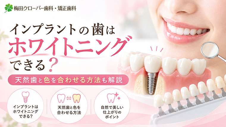 インプラントの歯はホワイトニングできる？天然歯との色を合わせる方法も解説