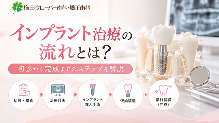 インプラント治療の流れとは？初診から完成までのステップを解説