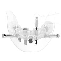 サージカルガイド