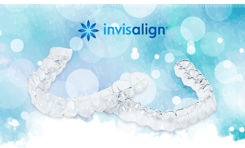 誰にも気づかれないマウスピース矯正、インビザライン