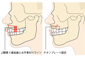 ゠ZbgobN(o)